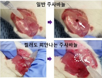 주사바늘을 찌른 뒤 피가 맺히는 일반 주사(위)와 출혈이 거의 없는 연구 결과(아래) - 한국과학기술원(KAIST) 제공